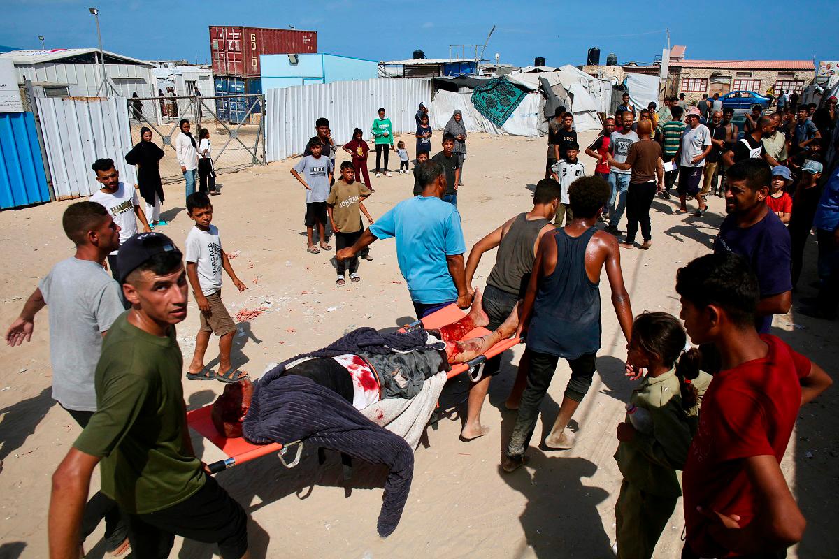 A Palestinian man who was injured while seeking humanitarian aid at the Rafah corridor, is carried into a field hospital in the Mawasi area of Rafah in the southern Gaza Strip on July 30, 2025. - AFPpix