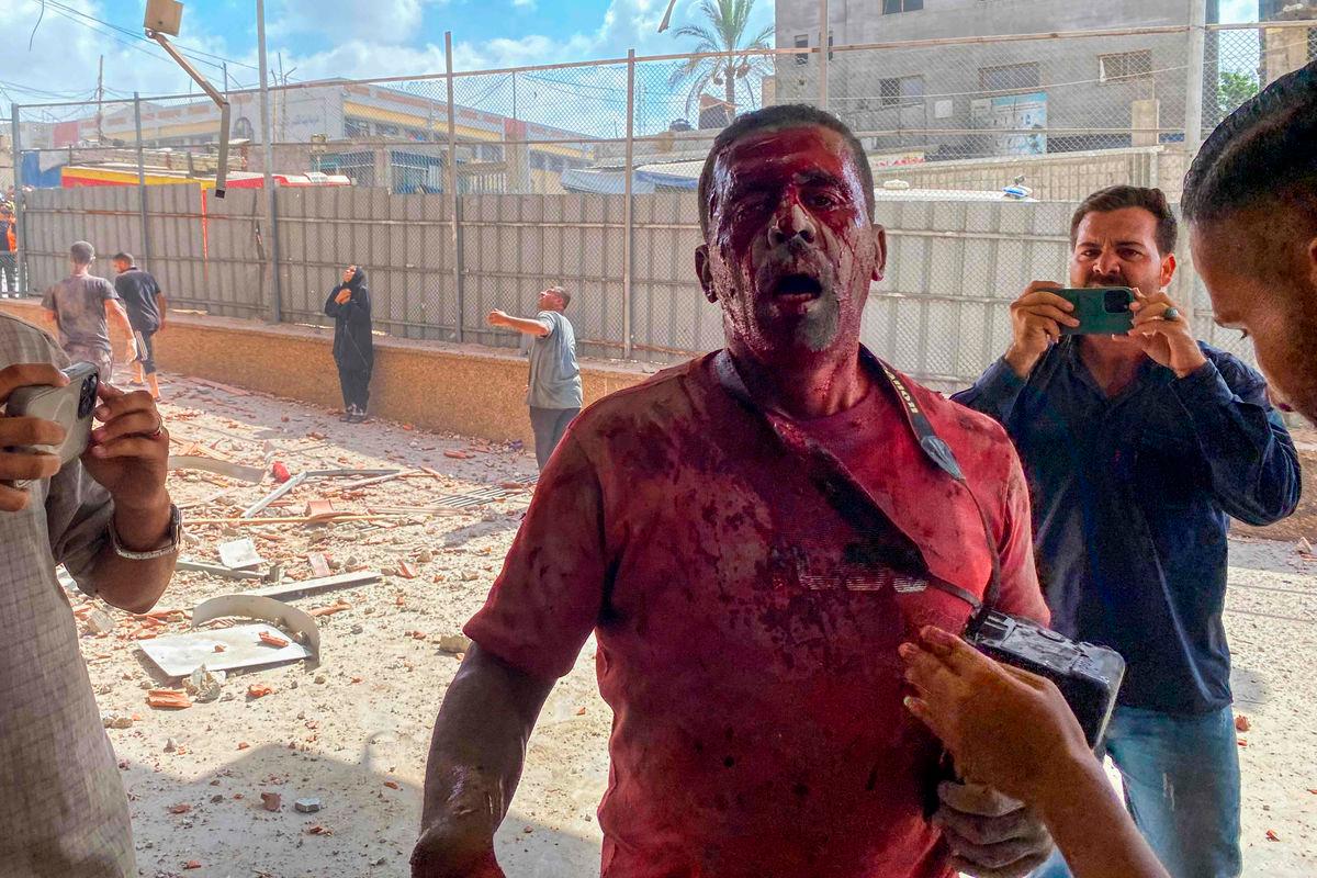 Palestinian photojournalist Hatem Omar reacts after being injured in an Israeli strike on Nasser Hospital in Khan Yunis, in the southern Gaza Strip, on August 25, 2025. An Al Jazeera journalist was killed in Gaza, a spokesperson for the Qatar-based TV network said on August 24. Mohammad Salama’s death was “confirmed”, the spokesperson said, after Al Jazeera reported he was killed in an Israeli strike. (Photo by AFP)