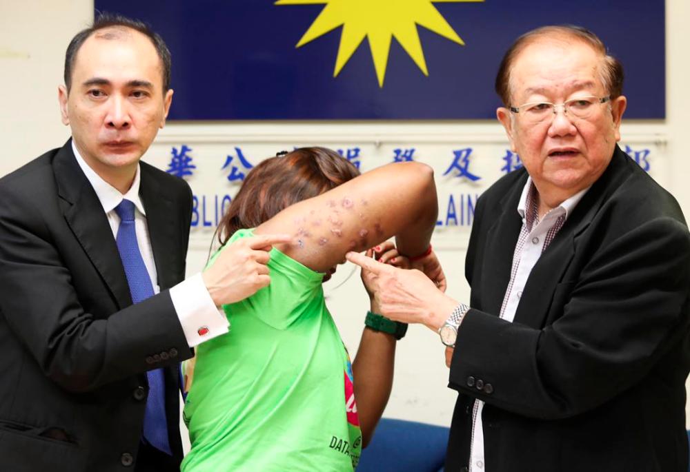 Lawyer James Ee (L), victim Nanthini (C) and Datuk Seri Micheal Chong showing the wounds on Nanthini’s arms during a press conference at the Wisma MCA, Kuala Lumpur on March 27, 2019. — Sunpix by Norman Hiu