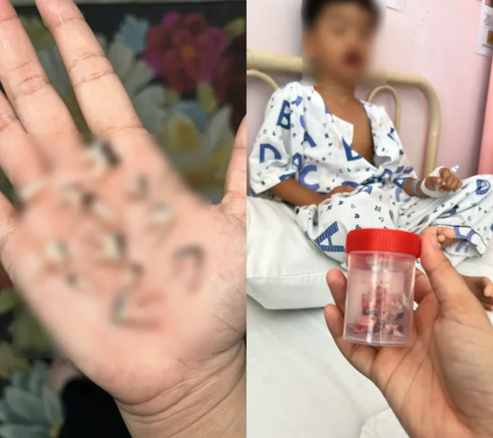 image-1 (1) boy loses 12 teeth