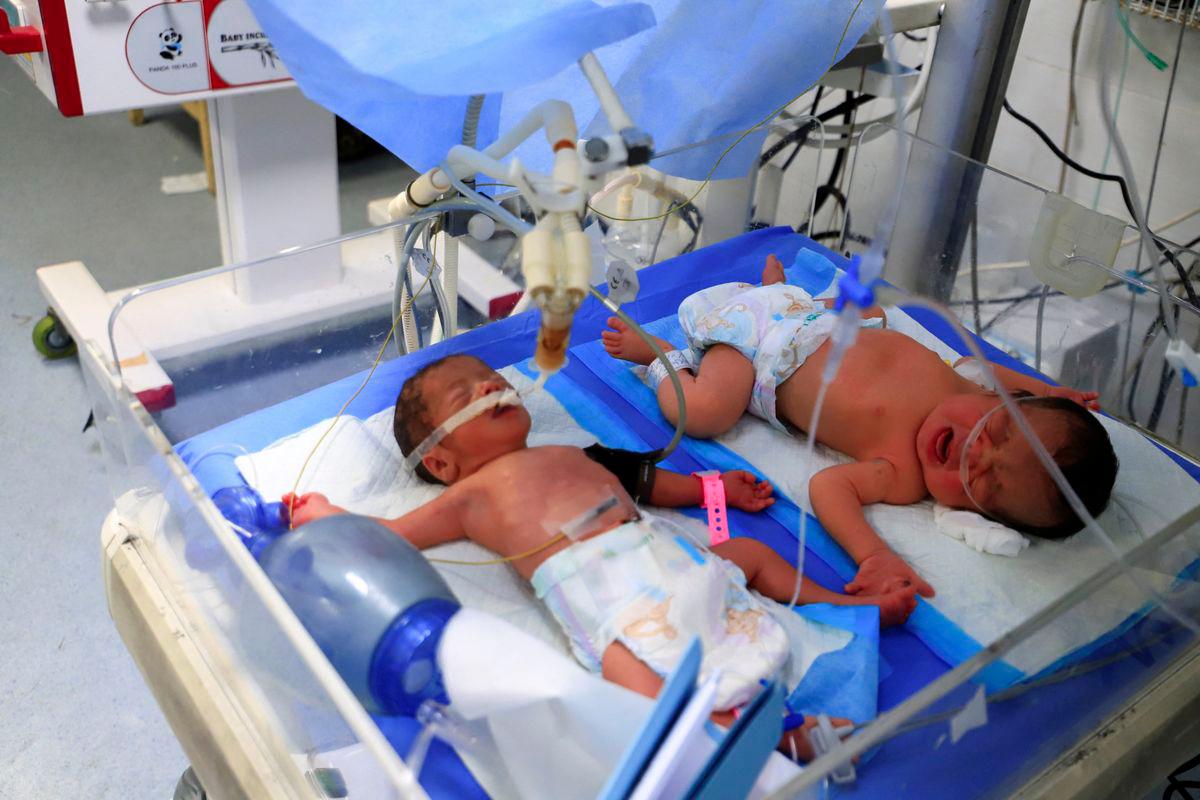 112 kanak-kanak Gaza dihospital setiap hari akibat kekurangan zat makanan 112 kanak-kanak Gaza dihospital setiap hari akibat kekurangan zat makanan