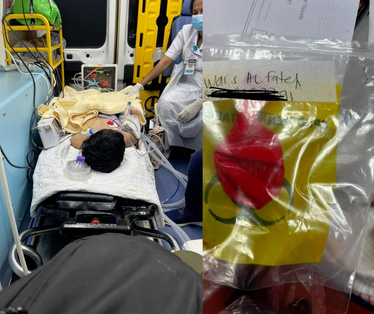 “Almost lost him”: Mum recounts son’s near-death after choking on balloon at birthday party “Almost lost him”: Mum recounts son’s near-death after choking on balloon at birthday party