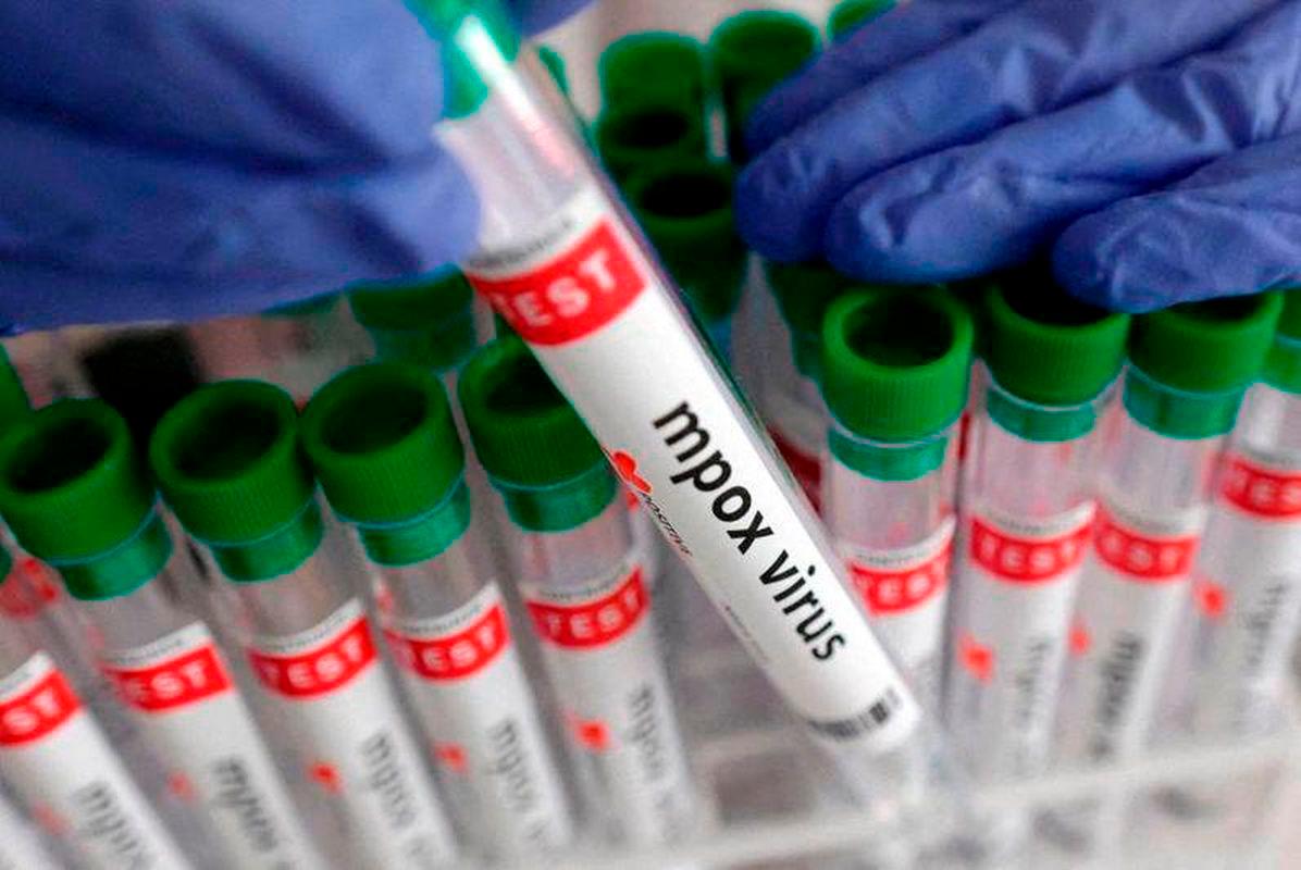 Kenya reports 314 mpox cases with 5 deaths as surveillance intensifies
