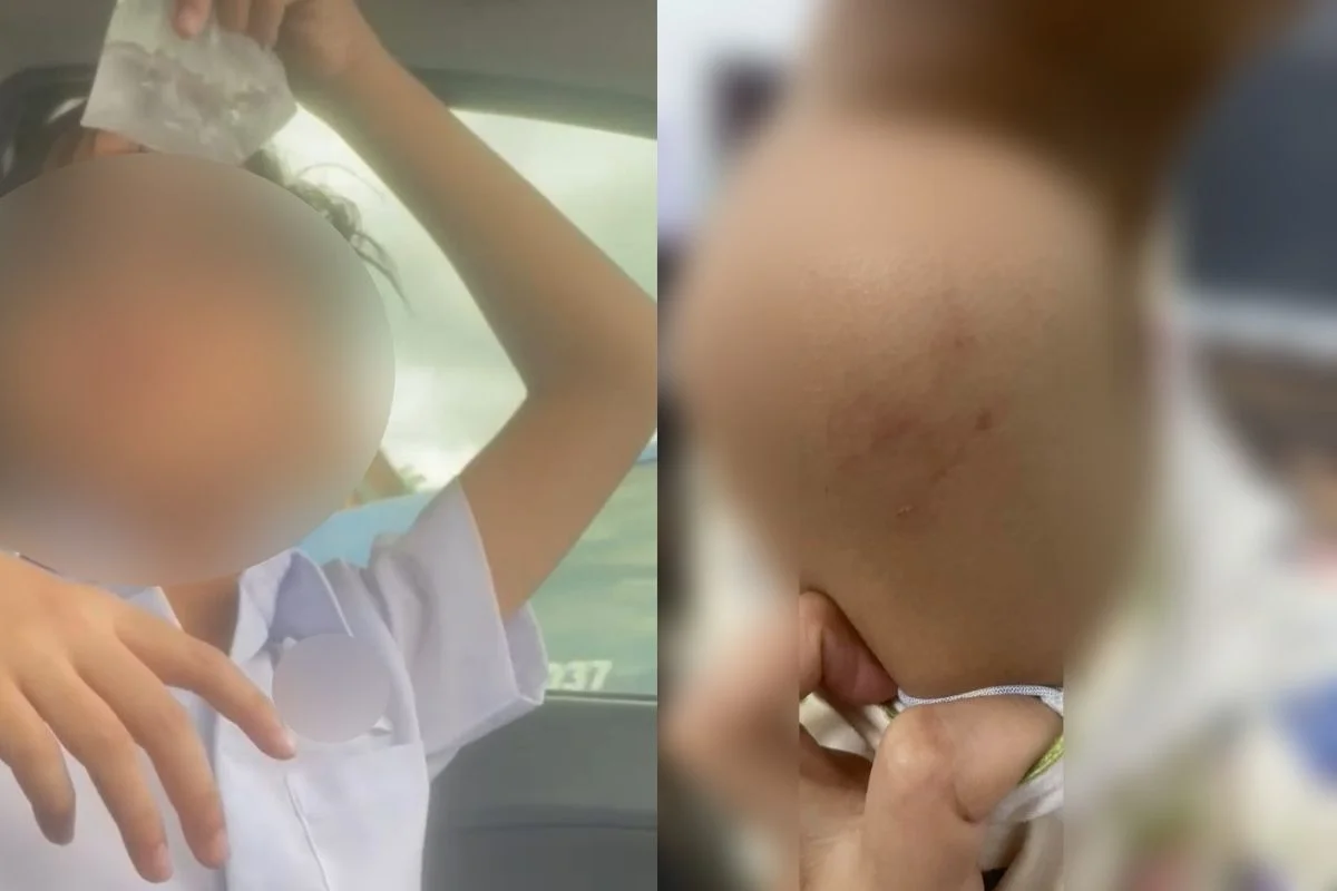 M_sian_mum_alarmed_as_son_returns_from_first_school_day_bruised