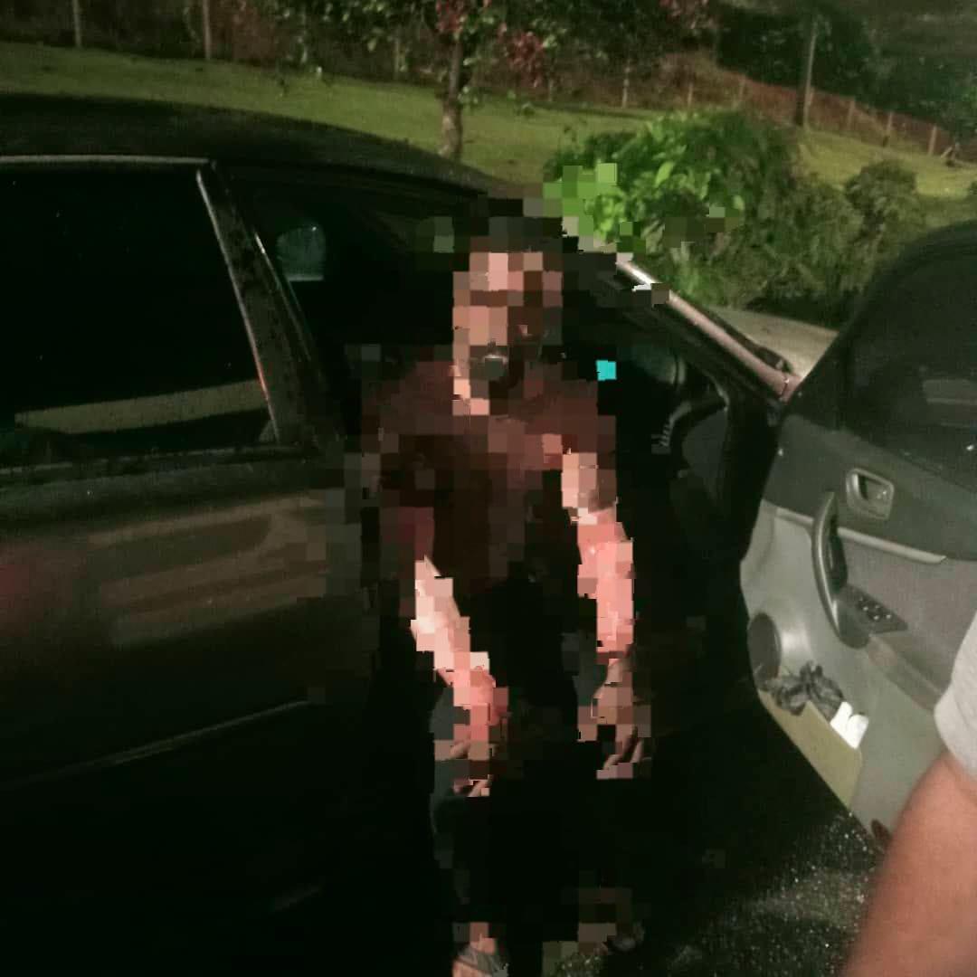 Man and girlfriend suffer severe burns in toll plaza fire incident Man and girlfriend suffer severe burns in toll plaza fire incident