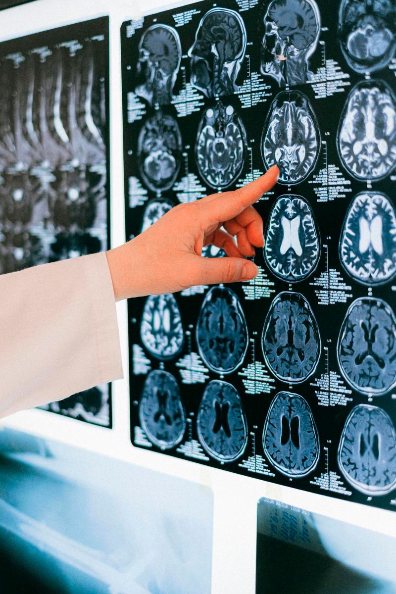 US approves first blood test for Alzheimer's