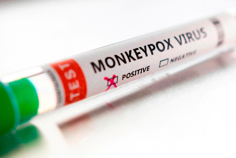 Cambodian man diagnosed with monkeypox