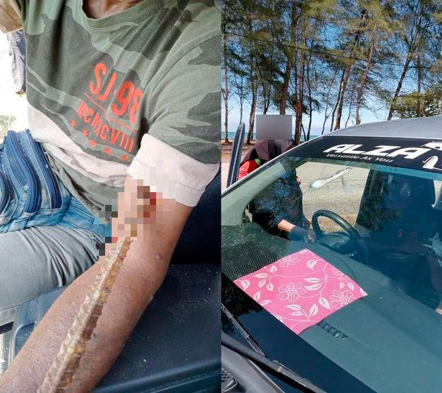 Driver almost reaches his “Final Destination” as metal rod smashes windshield, pierces arm Driver almost reaches his “Final Destination” as metal rod smashes windshield, pierces arm