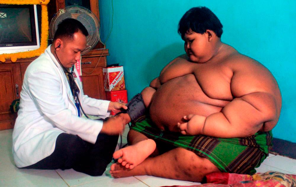 Fast-food and obesity