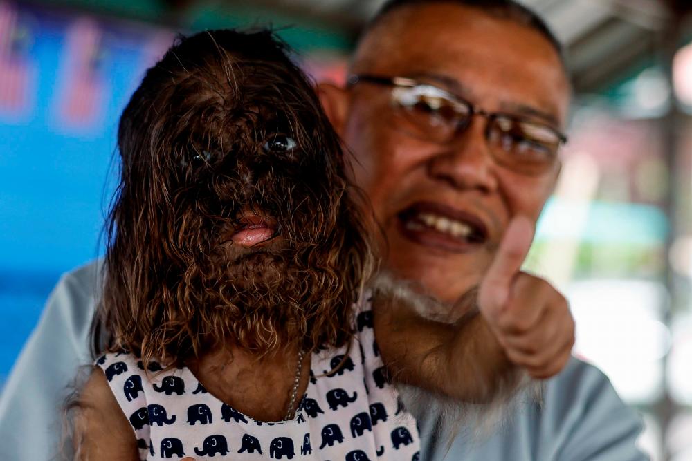 Father of child with Werewolf Syndrome cherishes King’s advice