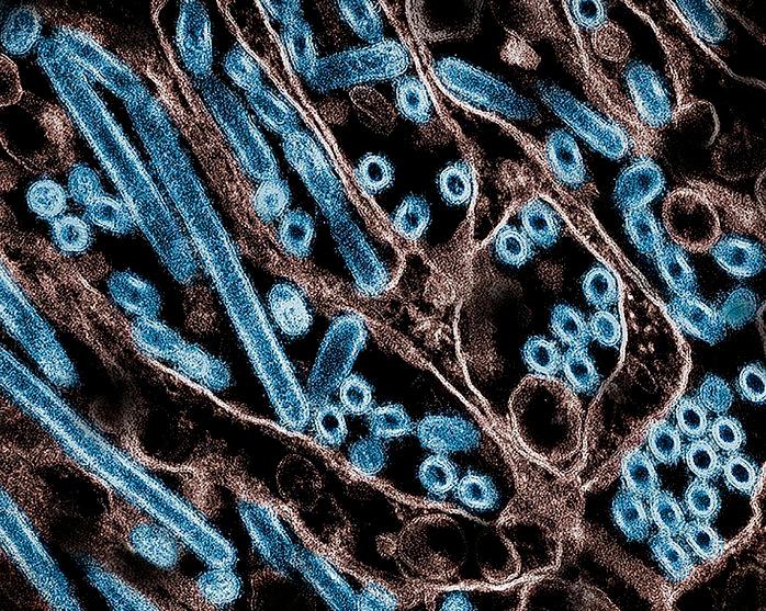 US records its first human death from bird flu US records its first human death from bird flu