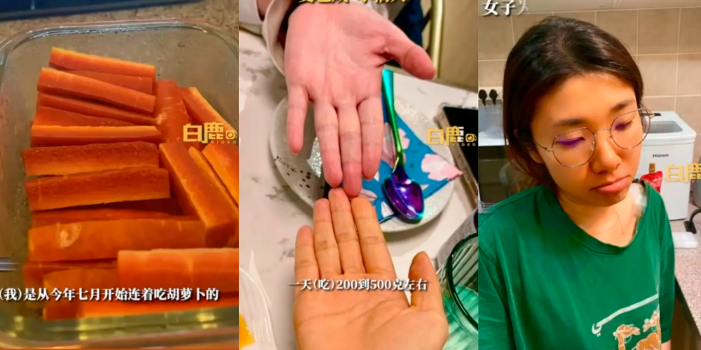 Woman turns orange after eating only carrots for three months