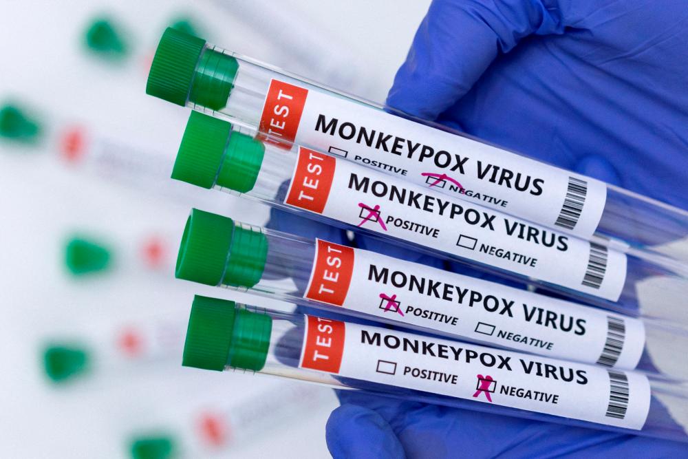 14 casual contacts of M'sian in S'pore infected with monkeypox free of disease
