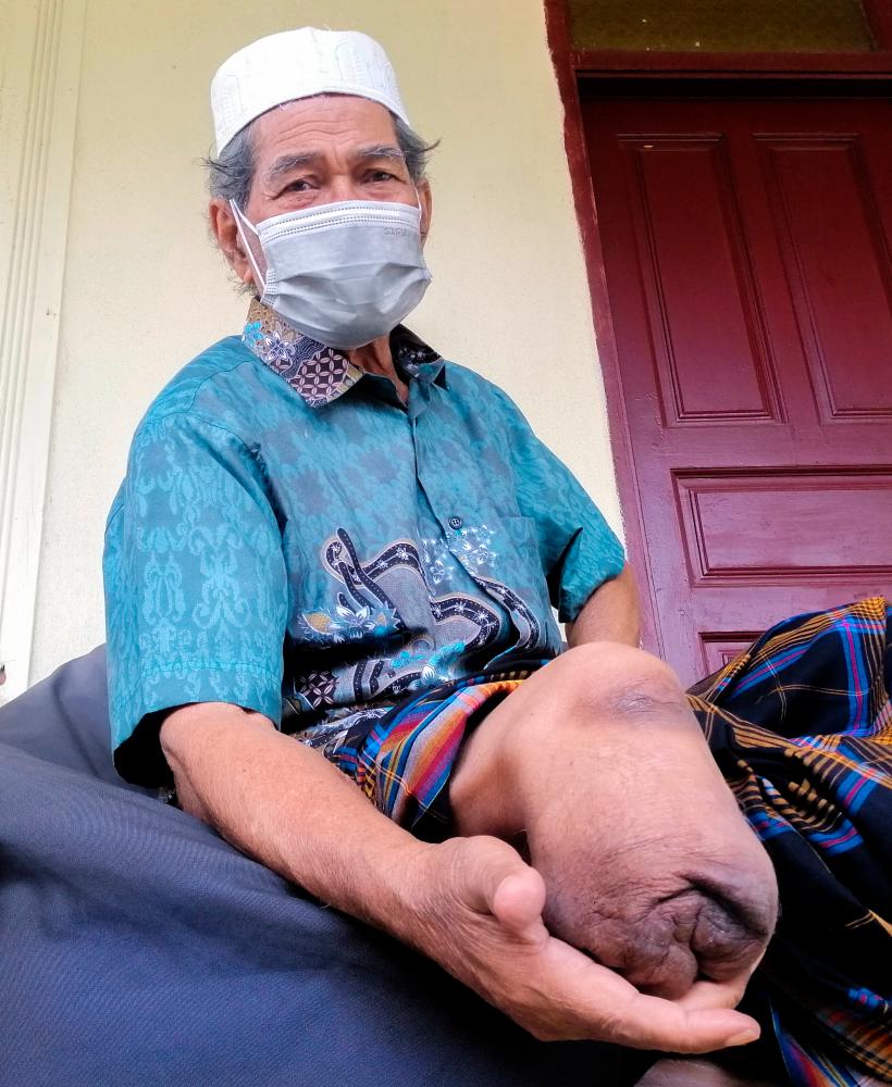 Former GOF personnel recalls losing leg after stepping on a booby trap Former GOF personnel recalls losing leg after stepping on a booby trap