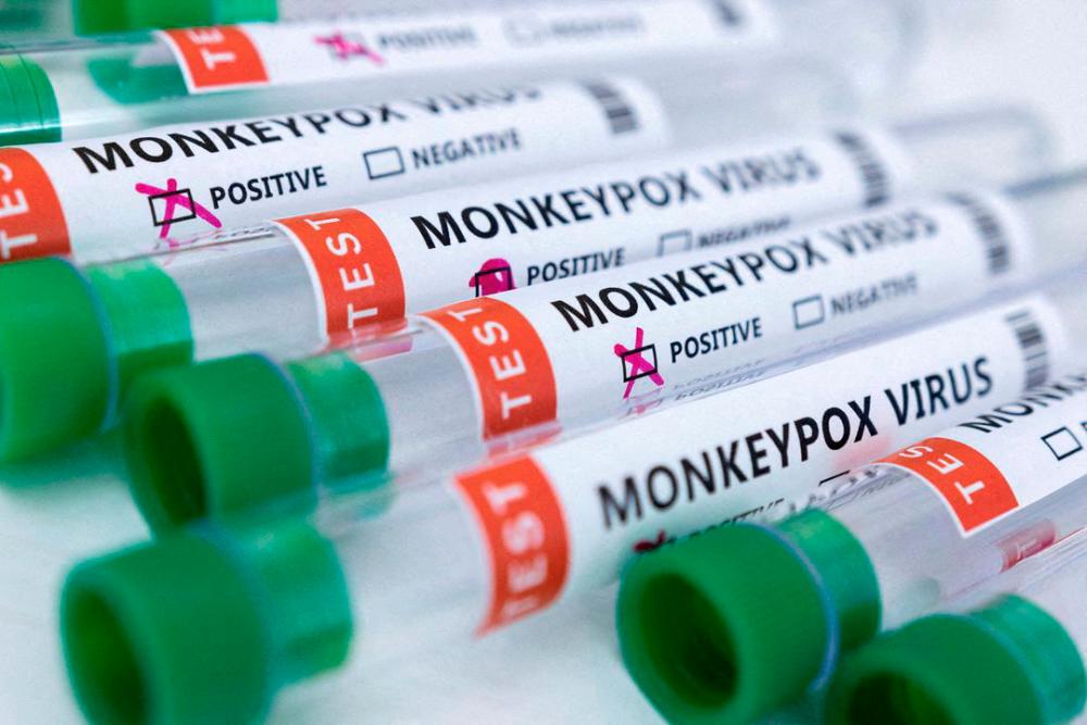 No new Monkeypox cases reported in Thailand