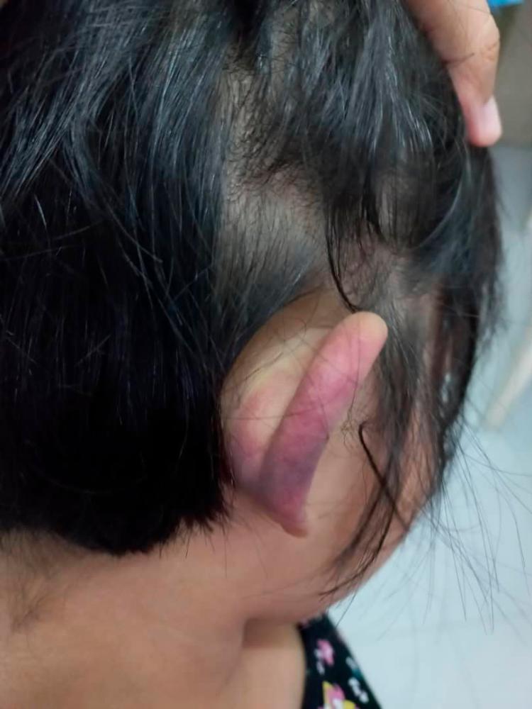 Police open investigation paper on alleged abuse of child with autism