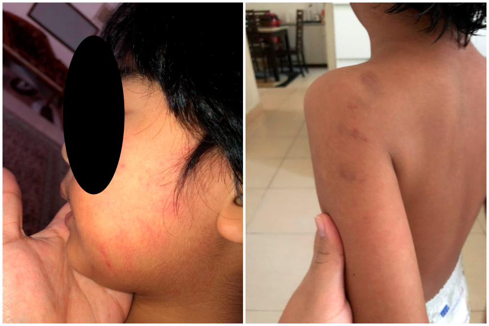 Woman’s claim of autistic son abused under police probe Woman’s claim of autistic son abused under police probe