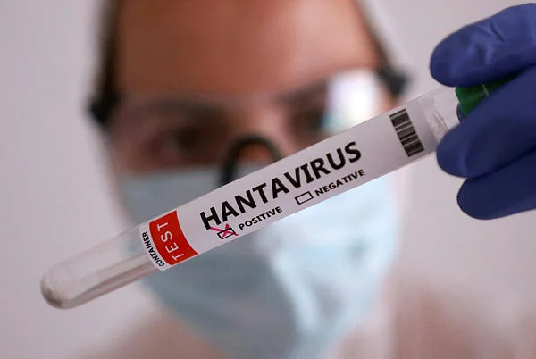 Chile says tourists not infected with hantavirus in the country Chile says tourists not infected with hantavirus in the country
