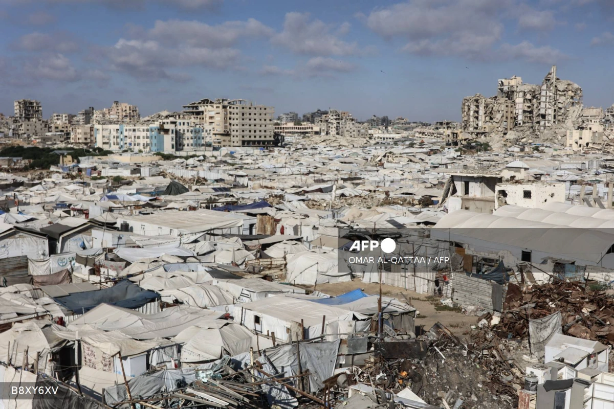 Chickenpox outbreak surges in Gazas crowded camps Chickenpox outbreak surges in Gaza’s crowded camps